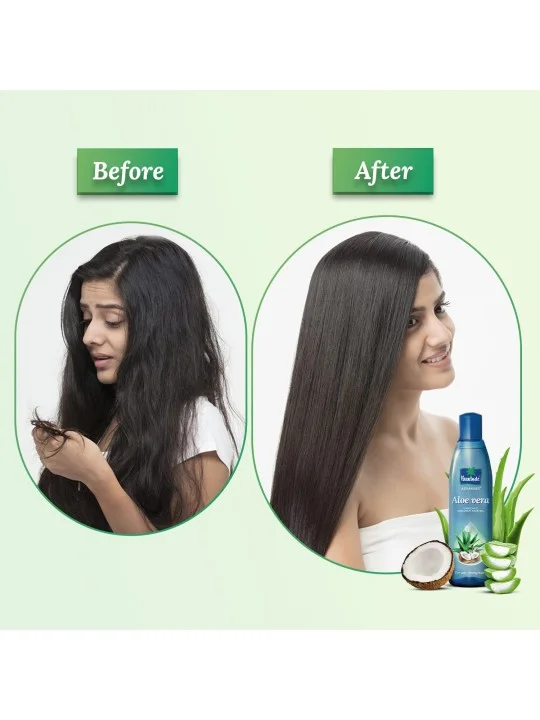 Parachute Advansed Aloe Vera Hair Oil With Coconut, Best For Stronger,  Softer Hair With Shine, 150Ml -